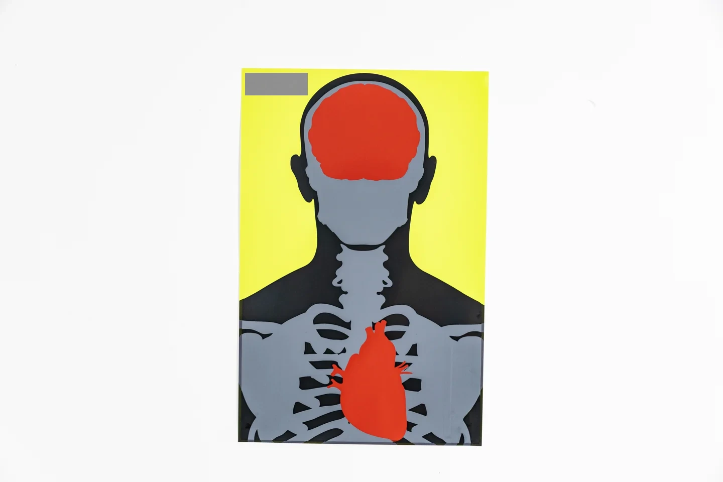 Anatomical reference target